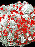 دانشمندان آمریکایی امیدوارند با استفاده از اثرات مخرب ویروس ایدز، سلول های سرطانی را از بین ببرند.